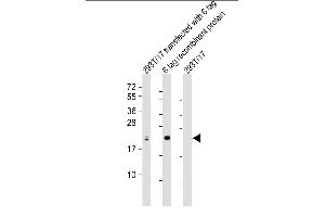 All lanes : Anti-S1 tag Antibody Antibody at 1:2000 dilution Lane 1: 293T/17 transfected with 6 tag lysate Lane 2: 6 tag recombinant protein lysate Lane 3: 293T/17 whole cell lysate Lysates/proteins at 20 μg per lane. (S1-Tag 抗体)