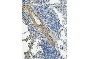 IHC analysis of VCL using anti-VCL antibody (ABIN7599003). (Vinculin 抗体  (AA 1-149))
