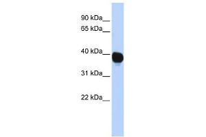 TPST2 antibody used at 1 ug/ml to detect target protein. (TPST2 抗体  (Middle Region))