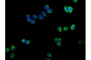 Immunofluorescence staining of PC-3 cells with ABIN7143116 at 1:100,counter-stained with DAPI. (ACTRT1 抗体  (AA 201-376))