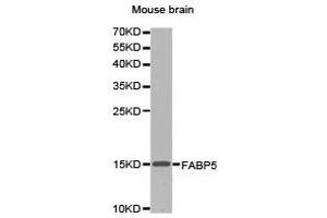 Western Blotting (WB) image for anti-Fatty Acid Binding Protein 5 (Psoriasis-Associated) (FABP5) antibody (ABIN1872637) (FABP5 抗体)