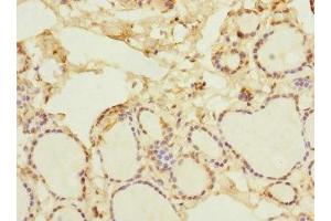 Immunohistochemistry of paraffin-embedded human thyroid tissue using ABIN7161528 at dilution of 1:100 (NFKBIE 抗体  (AA 140-280))