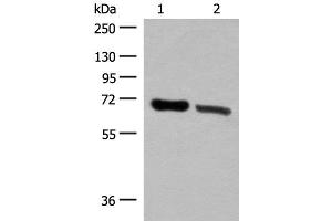Western blot analysis of Human placenta tissue and Human fetal brain tissue lysates using TRIM8 Polyclonal Antibody at dilution of 1:500 (TRIM8 抗体)