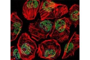 Fluorescent confocal image of U251 cell stained with TBP antibody at 1:25. (TBP 抗体  (AA 210-239))