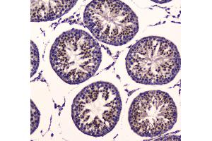 Immunohistochemistry (IHC) image for anti-3-phosphoinositide Dependent Protein Kinase-1 (PDPK1) (AA 107-336) antibody (ABIN5692784)
