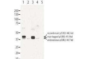 Western blot using  affinity purified anti-RRM2B antibody shows detection of recombinant (lanes 1 and 3) and endogenous protein (lanes 1 to 4) in whole cell extracts from transfected 293T. (RRM2B 抗体  (N-Term))