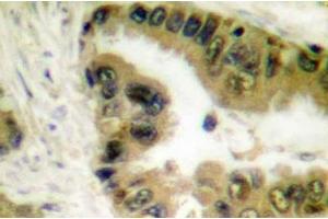 Image no. 1 for anti-Histone Deacetylase 10 (HDAC10) antibody (ABIN265454) (HDAC10 抗体)