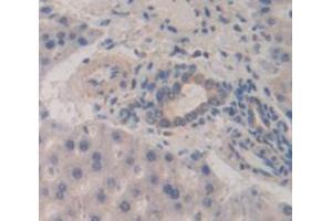 Immunohistochemistry (IHC) image for anti-Cadherin 13 (CDH13) (AA 478-690) antibody (ABIN1858335)