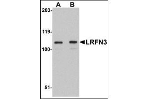LRFN3 antibody  (Center)