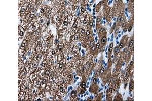 Immunohistochemical staining of paraffin-embedded liver tissue using anti-BHMT mouse monoclonal antibody. (BHMT 抗体)