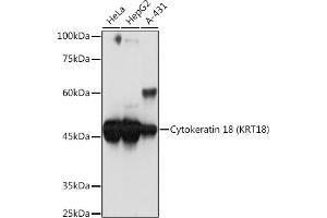 Western blot analysis of extracts of various cell lines, using Cytokeratin 18 (KRT18) Rabbit mAb (ABIN7268097) at 1:1000 dilution. (Cytokeratin 18 抗体)