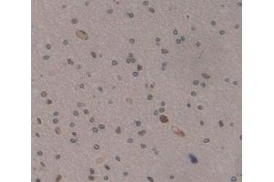 Used in DAB staining on fromalin fixed paraffin- embedded Kidney tissue (MEF2A 抗体  (AA 1-162))