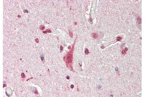 Rabbit Anti-Mxi1 antibody  Formalin Fixed Paraffin Embedded Tissue: Human Brain, Cortex Primary antibody Concentration: 1:200 Secondary Antibody: Donkey anti-Rabbit-Cy3 Secondary Antibody Concentration: 1:200 Magnification: 20x Exposure Time: 0. (MXI1 抗体  (N-Term))