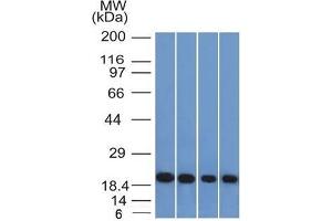 Western Blotting (WB) image for anti-Ferritin, Light Polypeptide (FTL) (AA 38-165) antibody (ABIN6939458)