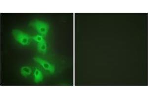 Immunofluorescence analysis of HeLa cells, using JIP2 Antibody. (IB2 抗体  (AA 581-630))