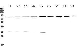 Western blot analysis of CD2AP using anti-CD2AP antibody . (CD2AP 抗体  (AA 253-337))
