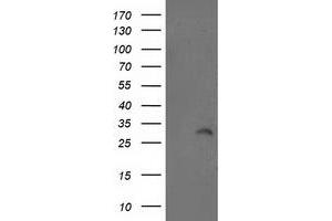 Western Blotting (WB) image for anti-Integral Membrane Protein 2B (ITM2B) antibody (ABIN1496395) (ITM2B 抗体)
