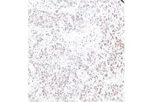 Immunohistochemistry (IHC) image for anti-Interferon, gamma-Inducible Protein 16 (IFI16) (AA 350-400) antibody (ABIN7795822)