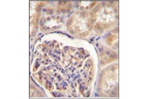 Immunohistochemistry analysis in formalin fixed and paraffin embedded human kidney tissue stained with CYP27B1 Antibody (C-term) Cat. (CYP27B1 抗体  (C-Term))
