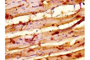 IHC image of ABIN7155352 diluted at 1:500 and staining in paraffin-embedded human skeletal muscle tissue performed on a Leica BondTM system.