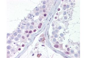 Anti-UTF1 antibody IHC of human testis. (UTF1 抗体  (AA 251-300))