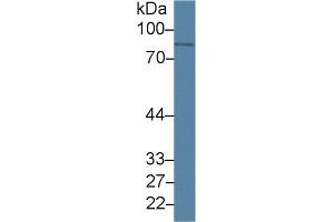 Western Blotting (WB) image for anti-Phospholipase A2, Group IVA (Cytosolic, Calcium-Dependent) (PLA2G4A) (AA 1-178) antibody (ABIN7427708)