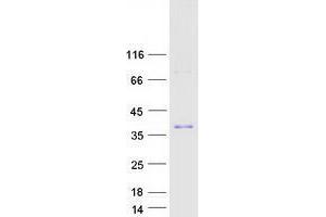 Validation with Western Blot (ZFAND5 Protein (Transcript Variant C) (Myc-DYKDDDDK Tag))