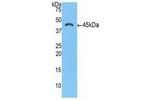Detection of Recombinant a1ACT, Human using Polyclonal Antibody to Alpha-1-Antichymotrypsin (a1ACT) (SERPINA3 抗体  (AA 235-394))