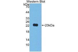 Western Blotting (WB) image for anti-Junctional Adhesion Molecule 2 (JAM2) (AA 74-250) antibody (ABIN1868793) (JAM2 抗体  (AA 74-250))