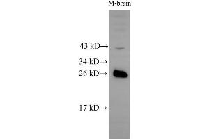 Western Blot analysis of Mouse brain tissue using RAB5B Polyclonal Antibody at dilution of 1:500 (RAB5B 抗体)