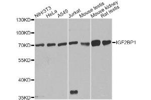 Western blot analysis of extracts of various cell lines, using IGF2BP1 antibody. (IGF2BP1 抗体)
