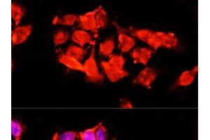 Immunofluorescence analysis of 293T cells using A1BG Polyclonal Antibody at dilution of 1:100 (40x lens). (A1BG 抗体)