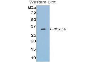Western blot analysis of the recombinant protein. (OTUB1 抗体  (AA 1-271))
