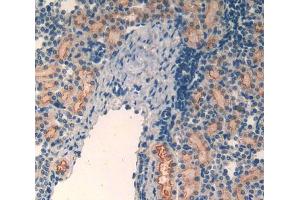 IHC-P analysis of kidney tissue, with DAB staining. (MT2 抗体  (AA 1-61))