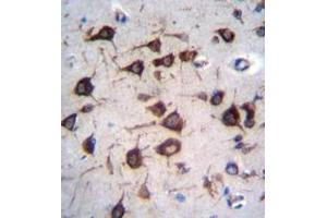 Immunohistochemistry (Paraffin-embedded Sections) (IHC (p)) image for anti-Eukaryotic Translation Elongation Factor 1 alpha 2 (EEF1A2) (AA 365-395), (C-Term) antibody (ABIN952027)