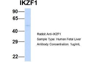Host:  Rabbit  Target Name:  IKZF1  Sample Type:  Human Fetal Liver  Antibody Dilution:  1. (IKZF1 抗体  (Middle Region))