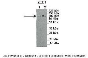Lanes:   1. (ZEB1 抗体  (N-Term))