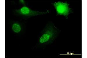 Immunofluorescence of monoclonal antibody to RPL11 on HeLa cell.