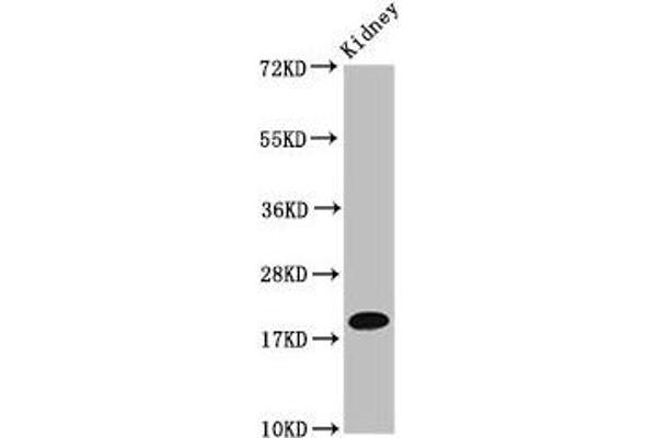 NAA38 抗体  (AA 2-173)