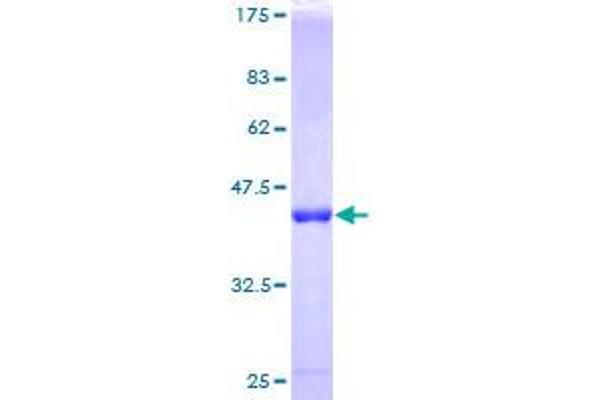 RABIF Protein (AA 1-123) (GST tag)