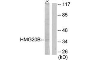 Western blot analysis of extracts from Jurkat cells, using HMG20B Antibody. (HMG20B 抗体  (AA 1-50))