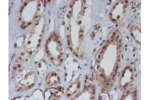 Image no. 3 for anti-ATR Interacting Protein (ATRIP) (AA 42-309) antibody (ABIN1491507) (ATRIP 抗体  (AA 42-309))
