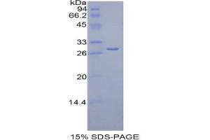 SDS-PAGE analysis of Rat Complement Factor H Protein. (Complement Factor H Protein (CFH))