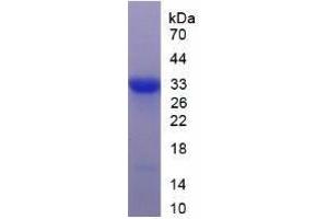 Image no. 1 for Dickkopf Homolog 1 (DKK1) (AA 33-266) (Active) protein (His tag) (ABIN6239907)