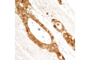 Immunohistochemistry (IHC) image for anti-Stratifin (SFN) (AA 198-248) antibody (ABIN7454767) (14-3-3 sigma/SFN 抗体  (AA 198-248))