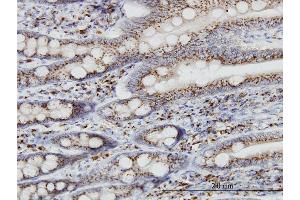 Immunoperoxidase of monoclonal antibody to TGOLN2 on formalin-fixed paraffin-embedded human small Intestine. (TGOLN2 抗体  (AA 229-327))