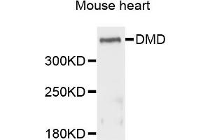 Western blot analysis of extracts of mouse heart cells, using DMD antibody. (Dystrophin 抗体)