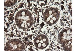 Image no. 3 for anti-TAP Binding Protein-Like (TAPBPL) antibody (ABIN1501300)