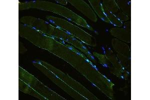 IF analysis of Laminin using anti-Laminin antibody (ABIN5692889).