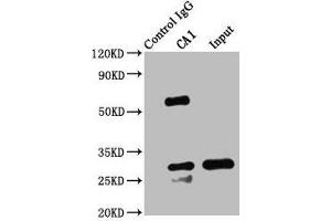 Immunoprecipitating CA1 in K562 whole cell lysate Lane 1: Rabbit control IgG instead of ABIN7146698 in K562 whole cell lysate.